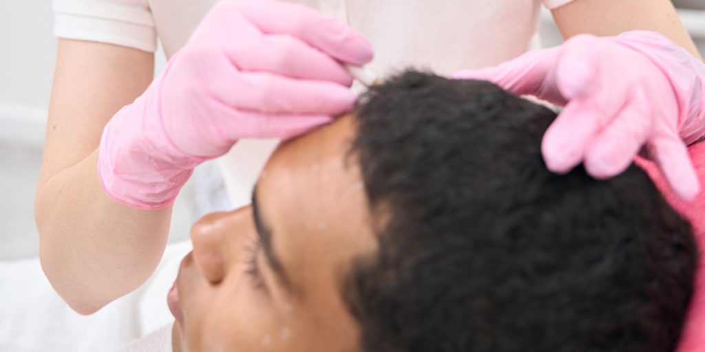  Benefits of Scalp Nourishment