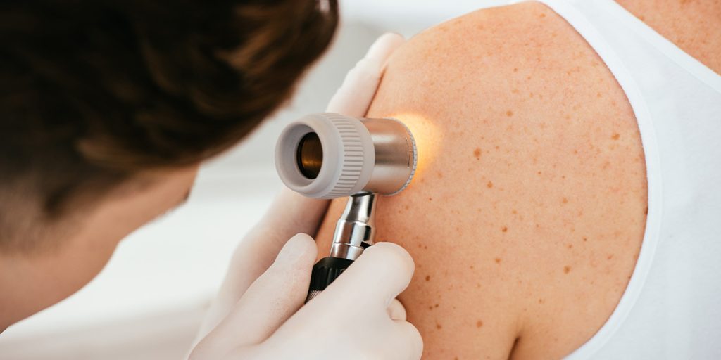  Guide to Laser Hair Removal